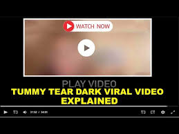 tummy tear orginal viral video mms, tummy tear leaked viral video, tummy tear X leaked viral dark video